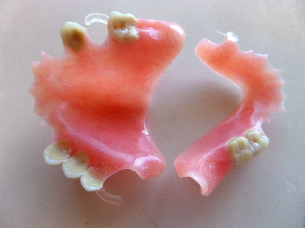 Partial Denture