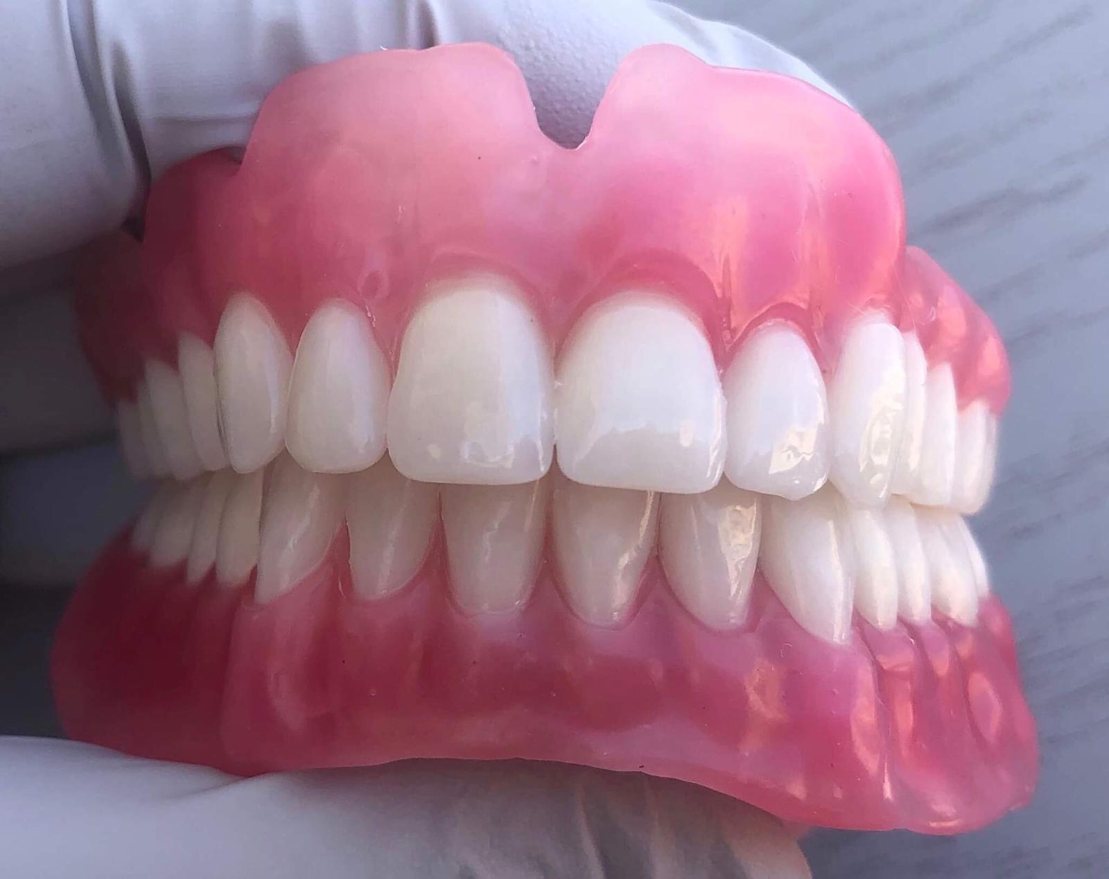 Full New Denture by Align Dentures
